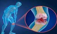 لبنیات، ویتامین D و تحرک؛ سه رکن پیشگیری از پوکی استخوان از کودکی تا سالمندی